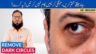 Dark Circles Ka Ilaj - Get Rid of Dark Circles Fast - Ankhon Ke Halke Khatam Karen  | Dr. Ibrahim