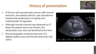 JACC: Case Reports Video Case Presentation: Imaging