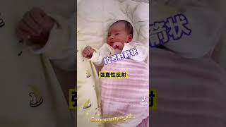 人類幼崽熱門反射有哪些？#mommyego #寶寶 #育兒經驗分享