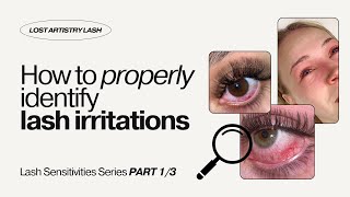 Eyelash Extension REACTION? How to identify lash glue allergies, chemical burn and scraped sclera.