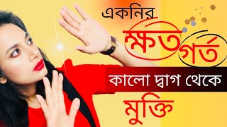 একনির গর্ত ও স্পট দূর করার উপায়/How to Remove Acne Scars? Which Product will Remove Acne Scars