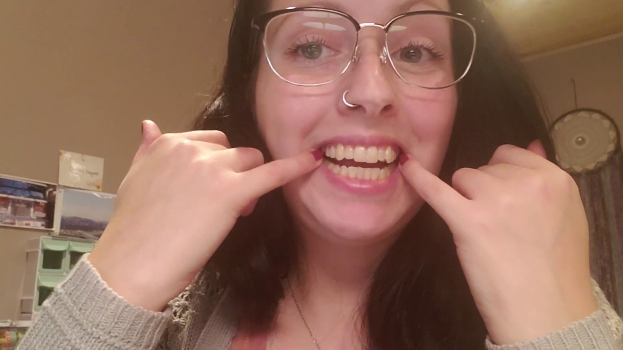 Invisalign Youtube