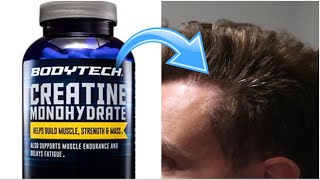 Does Creatine cause Hair Loss!? (Ft. Dodge Feeler)