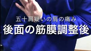 肩の痛みの改善【茨城県つくば市・牛久市の牛久カッパ整体院】