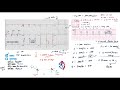 rate and rhythm normal sinus rhythm