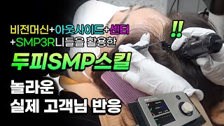 비전머신+아웃사이드니들+센터니들+SMP3R니들을 활용한 20분완성 두피문신 베이스작업 스킬영상