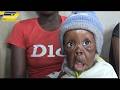 WATSOMBA FACE YeMwana Ane 9 Months Yave Kuita Kunge YeChembere, Kuroyiwa Here, Parents Appeal 4 Help