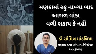 મણકા માં સ્ક્રુ નાખ્યા બાદ આગળ વાંકા વળી શકાય કે નહીં #slipdisc #sciatica #spinesurgeoninahmedabad