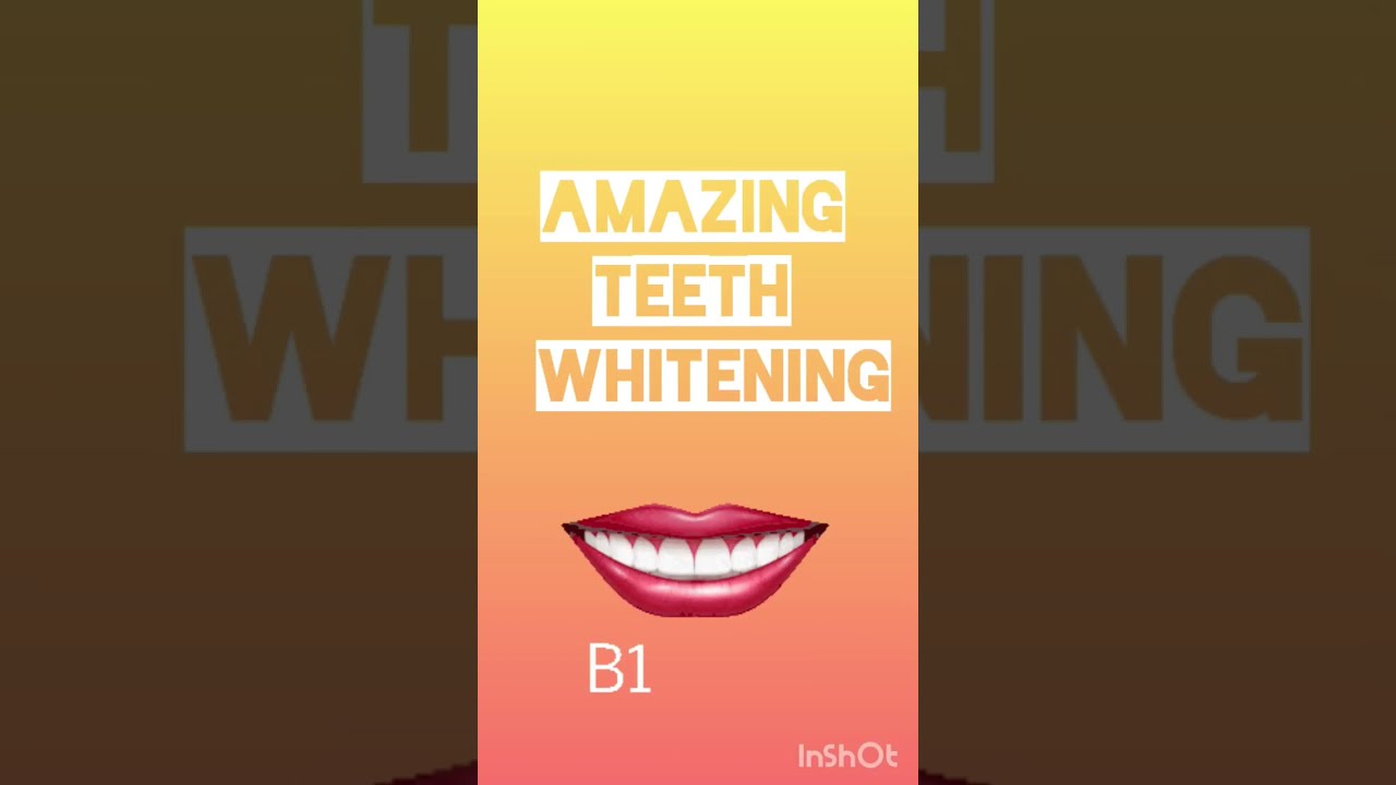 Teeth Whitening Live Demo Dr Srishti Bhatia Youtube