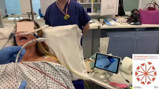 Awake tracheal intubation with the ProVu™️ video stylet: a case series