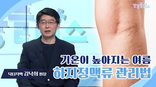 더운 여름 더욱 심해지는 하지정맥류 [건강플러스_닥터정맥]