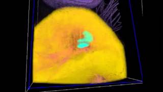 Fiber-based polarization-sensitive OCT for birefringence imaging of the anterior eye segment