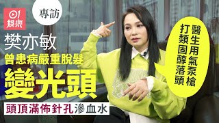 樊亦敏曾內分泌失調導致脫髮光頭   親解與劉家輝、羅兆輝關係｜01娛樂｜藝人專訪｜香港01｜香港小姐｜TVB｜陽光檸檬茶｜鄭伊健 ｜愛回家｜三太