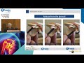 tips for arthroscopic rc repair of massive cuff tears e. antonogiannakis Όμιλος Υγεία