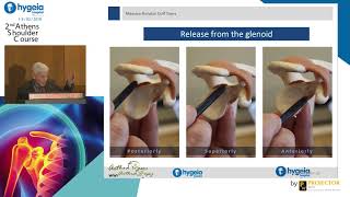 Tips for Arthroscopic RC Repair of Massive Cuff Tears - E. Antonogiannakis | Όμιλος Υγεία