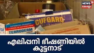 കുട്ടനാട്ടിൽ 8 പേർക്ക് എലിപ്പനി സ്ഥിരീകരിച്ചു; ആശങ്കപ്പെടേണ്ടെന്ന് ആരോഗ്യവകുപ്പ് | Rat Fever