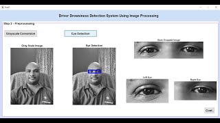 Driver Drowsiness Detection System Using Image Processing | MATLAB Final Year IEEE Project