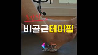 광주발목재활, 비골근 테이핑 #광주재활센터