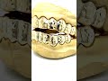 Gold diamond cut grillz by Seattle Gold Grills.  New style!