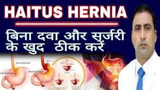HAITUS HERNIA || बिना दवा और सर्जरी के खुद  ठीक करें || Dr Kumar Education Clinic