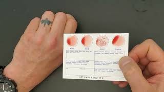 22 05 26 Blood Typing Kit How to using Eldoncard