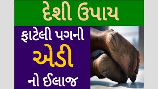 પગના વાઢીયા નો સચોટ ઈલાજ / ફાટેલી પગની એડીનો ઈલાજ / cracked heel solution