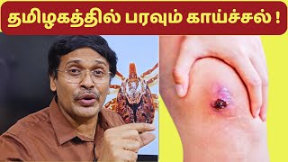 தமிழகத்தில் பரவும் காய்ச்சல் | symptoms and treatment tips Doctor Karthikeyan