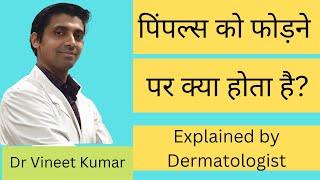 पिंपल्स को फोड़ने पर क्या होता है? | Should you pop your pimples? | VR Skin Clinic | Bikaner
