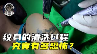 你知道纹身的清洗过程究竟有多恐怖吗？它到底是怎么洗掉的？