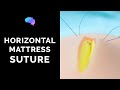 Horizontal Mattress Suture - OSCE Guide | UKMLA | CPSA | PLAB 2