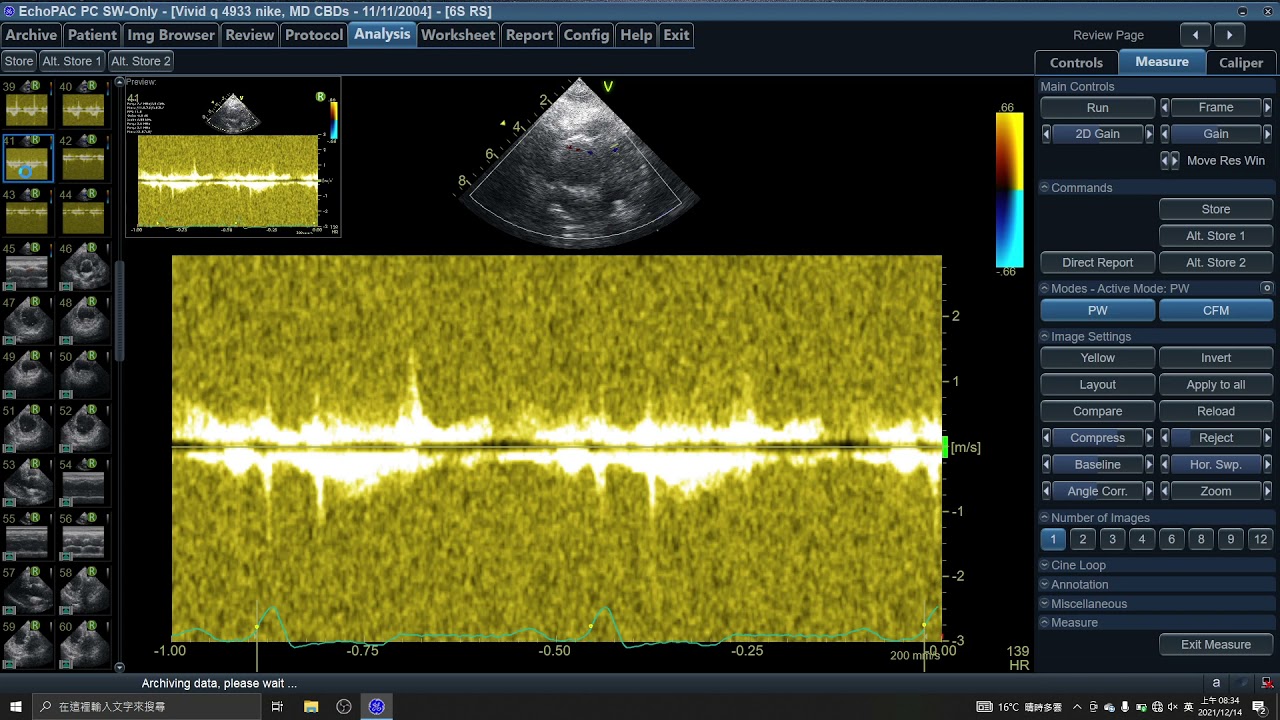 4933 Hemodynamic Measurement, Small Animal Echocardiography, Dog, CBDs ...