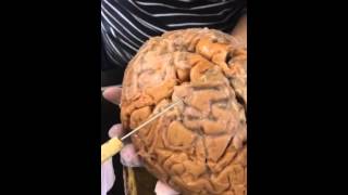 Whole Brain (bio 202)
