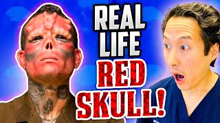 Plastic Surgeon Reacts to Real Life RED SKULL! Extreme Bodies Explained!