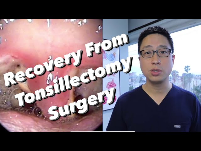 Tonsillectomy Recovery Tonsillectomy For Singers Effects On The Voice