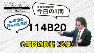 114B20 動画で学ぶ医師国試（MAC）心電図の診断（必修問題）（今日の1問）