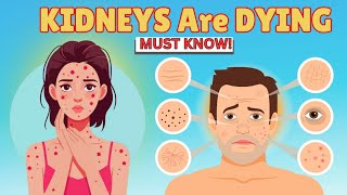 KIDNEYS are DYING! 10 Weird Signs of KIDNEY DAMAGE !