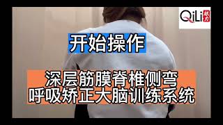 脊柱侧弯scoliosis