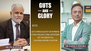 An Unpleasant Surprise: Unraveling the Mystery of Incidental Gallbladder Cancer