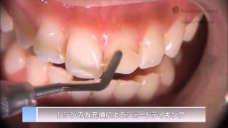 ESTELITE ASTERIA Clinical Guide (EN) | Tokuyama Dental