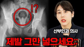 산부인과 의사를 화나게 하는 별걸 다 넣은 환자들