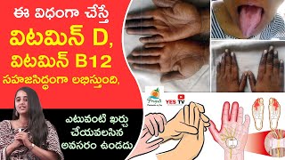 విటమిన్ D, విటమిన్ B 12 సహజసిద్ధంగా లభిస్తుంది|| Vitamin D ||Vitamin B12|| Deficiency || YES TV