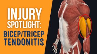 Injury Spotlight: Bicep \u0026 Tricep Tendonitis