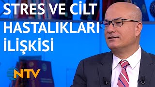 @NTV Stres cilt hastalıklarını artırıyor mu? (Adım Adım Sağlık)