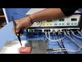 electrosurgical unit u0026 vessel sealer demonstration