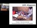 trypanosomiasis leishmaniasis chagas part 1 2013 global health disasters course