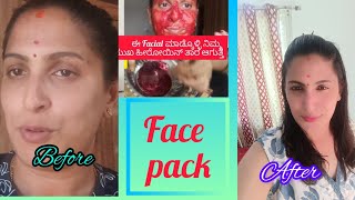 ಬಿಸಿಲಿನಿಂದ ಮುಖ ಎಷ್ಟೇ ಕಪ್ಪಾಗಿದರೂ ಈ ಅದ್ಬುತವಾದ face pack ಮಾಡ್ಕೊಳ್ಳಿ ಮುಖ  ತಕ್ಷಣ ಬೆಳ್ಳಗೆ ಆಗುತ್ತೆ