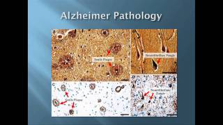 TEDxAlamo - George Perry -  Living with Aging: Alzheimer's, the Disease of Our Time