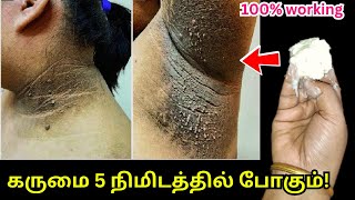 பார்லரில் காசு செலவு பண்ணுவதை விட 10 மடங்கு சூப்பர் ரிசல்ட்! Dark neck home remedy skin whitening