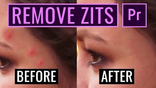 How To Remove PIMPLES, ZITS AND BLEMISHES FAST In Premiere Pro