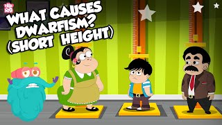 What Causes Dwarfism? | Growth Disorder | The Dr Binocs Show | Peekaboo Kidz